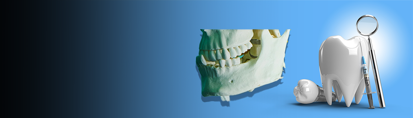 3d printing in dental