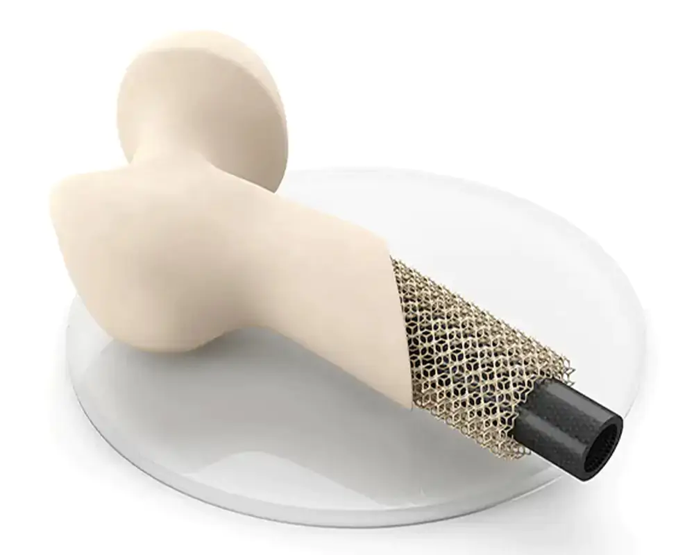 3d printing in dental