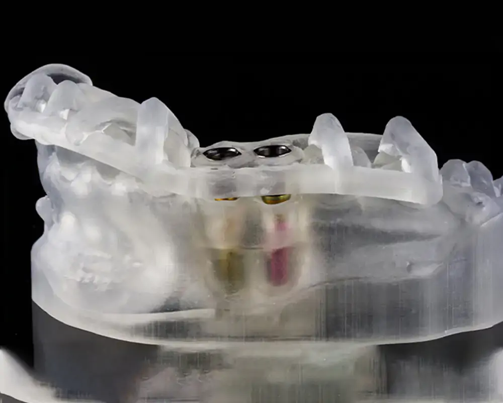 3d printing in dental